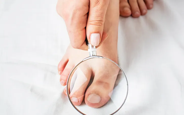 Eine Lupe über einem dicken Zeh