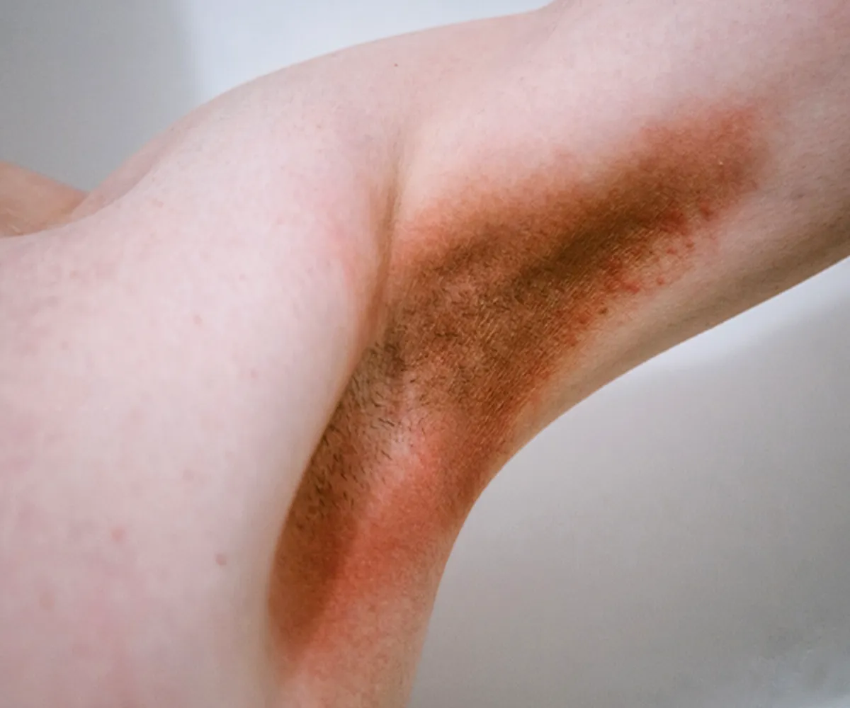 Nahaufnahme eines dunkel roten bis braunen Achselbereichs