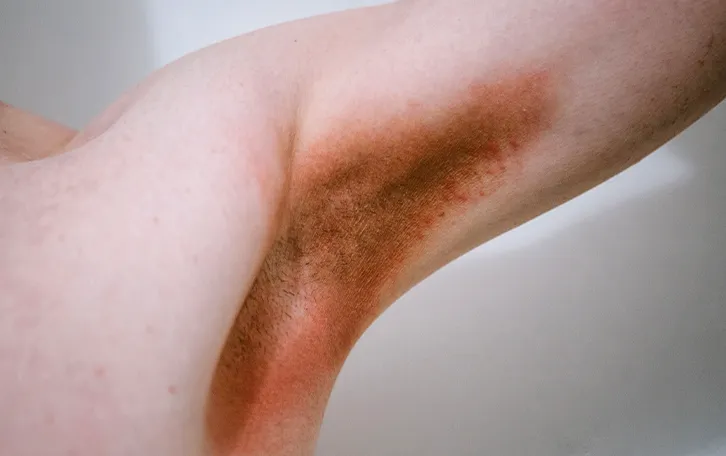 Nahaufnahme eines dunkel roten bis braunen Achselbereichs