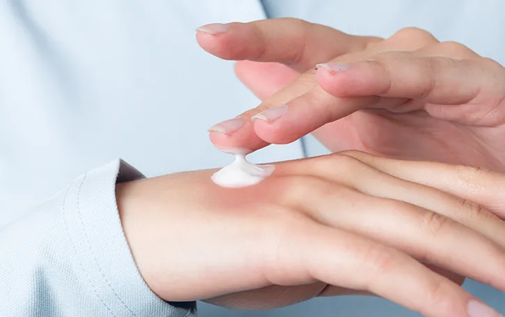 Pilzinfektionen Frühzeitige Behandlung Ein dicker Tropfen Creme auf einem Handrücken mit einem Finger darüber